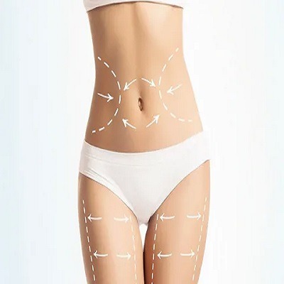 Liposuction in Riyadh