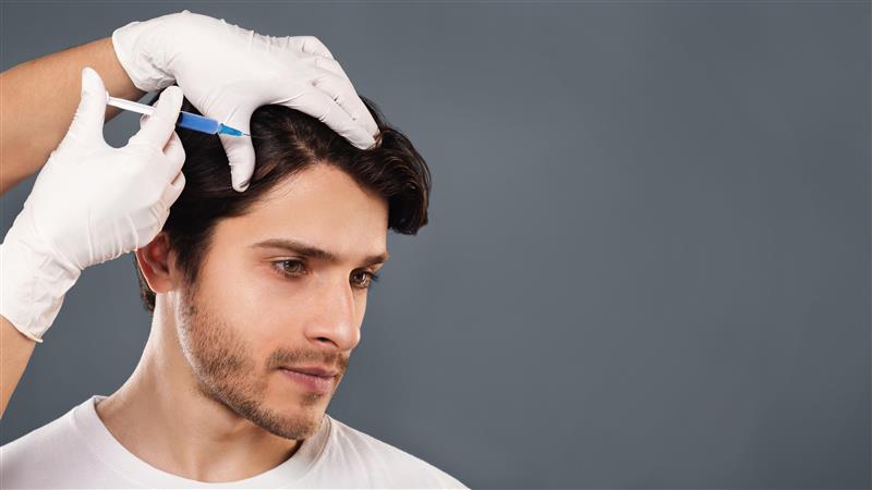 PRP hair treatment in Dubai