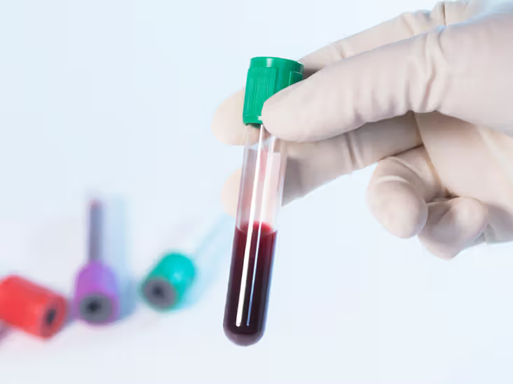 Platelet Count Test